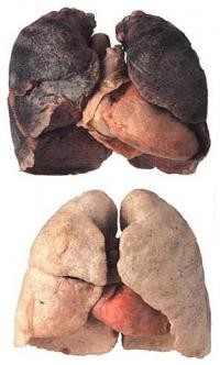 Der Vergleich einer gesunden Lunge ...