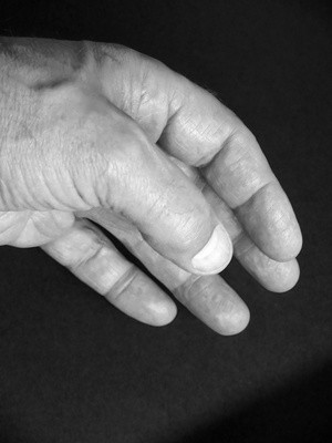 Kräftige Fingernägel brauchen Pflege