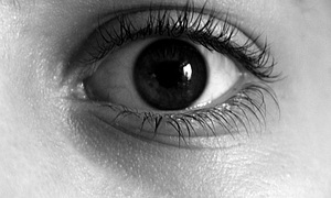 Dunkle Augenringe Ursachen Und Tipps